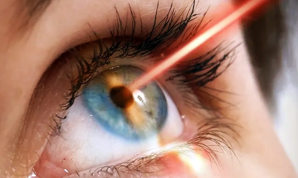 LASIK LASIK